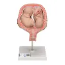 Fœtus jumeaux à 5 mois 3B Scientific® en position normale 