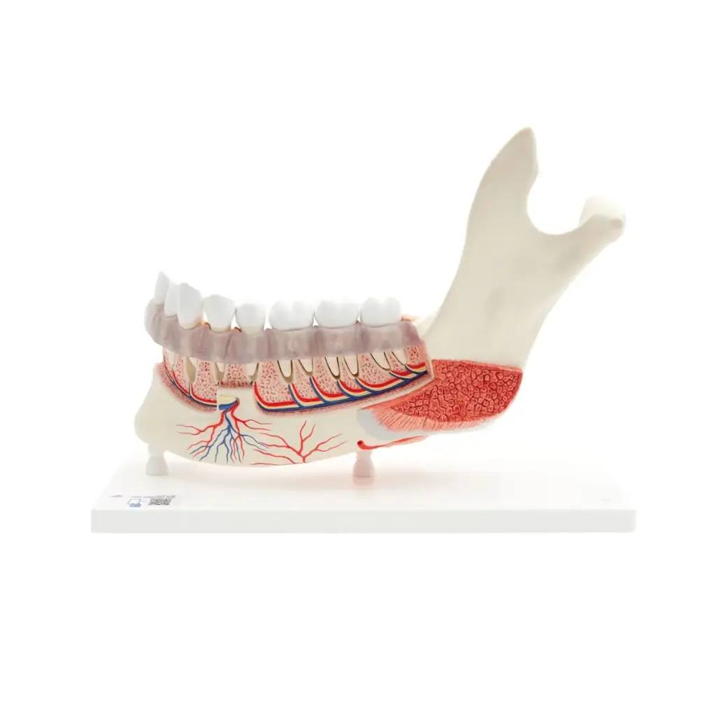 Hémi-mandibule 3B Scientific® avec 8 dents cariées, en 19 parties