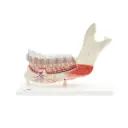 Hémi-mandibule 3B Scientific® avec 8 dents cariées, en 19 parties