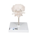 Atlas et axis avec occipital 3B Scientific®
