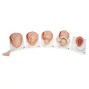 Accouchement en 5 stades 3B Scientific®