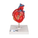 Cœur classique avec pontage 3B Scientific®