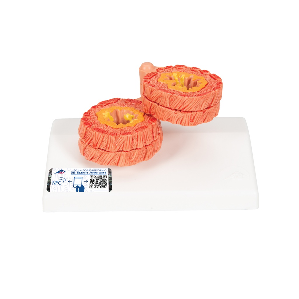 Modèle de BPCO 3B Scientific®