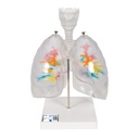 Arbre bronchique CT 3B Scientific®