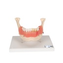 Maladie dentaire 3B Scientific®