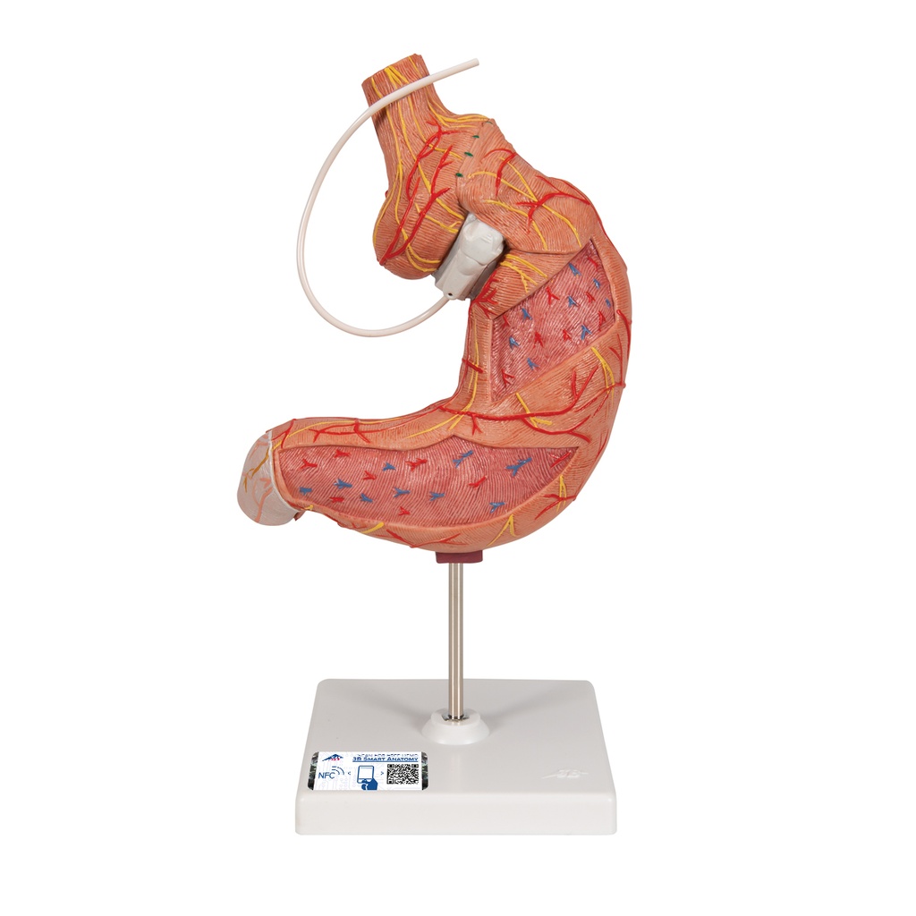 Modèle de bande gastrique 3B Scientific®