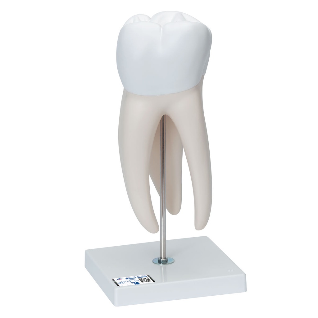Molaire géante avec caries dentaires 3B Scientific®