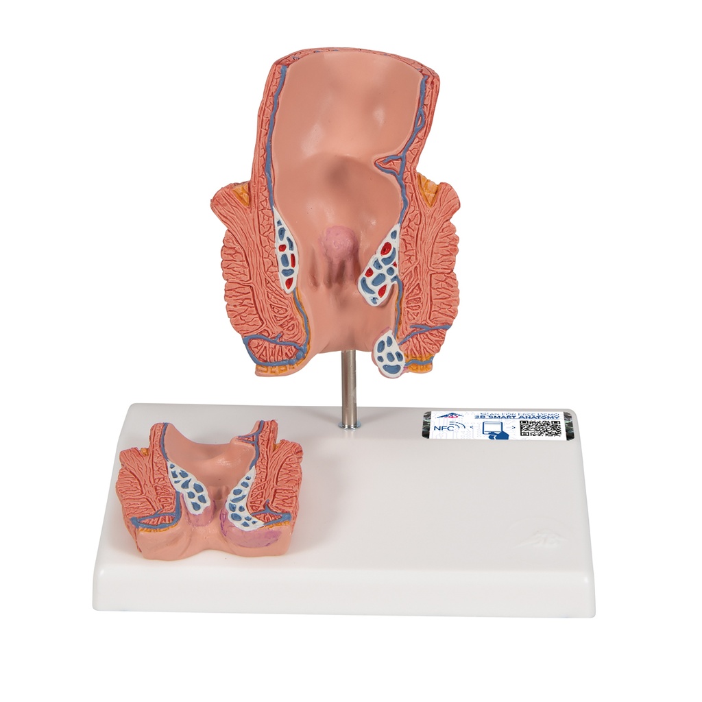 Modèle d'hémorroïdes 3B Scientific®
