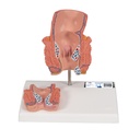Modèle d'hémorroïdes 3B Scientific®