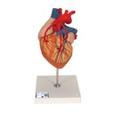 Cœur avec pontage en 2 exemplaires 3B Scientific®