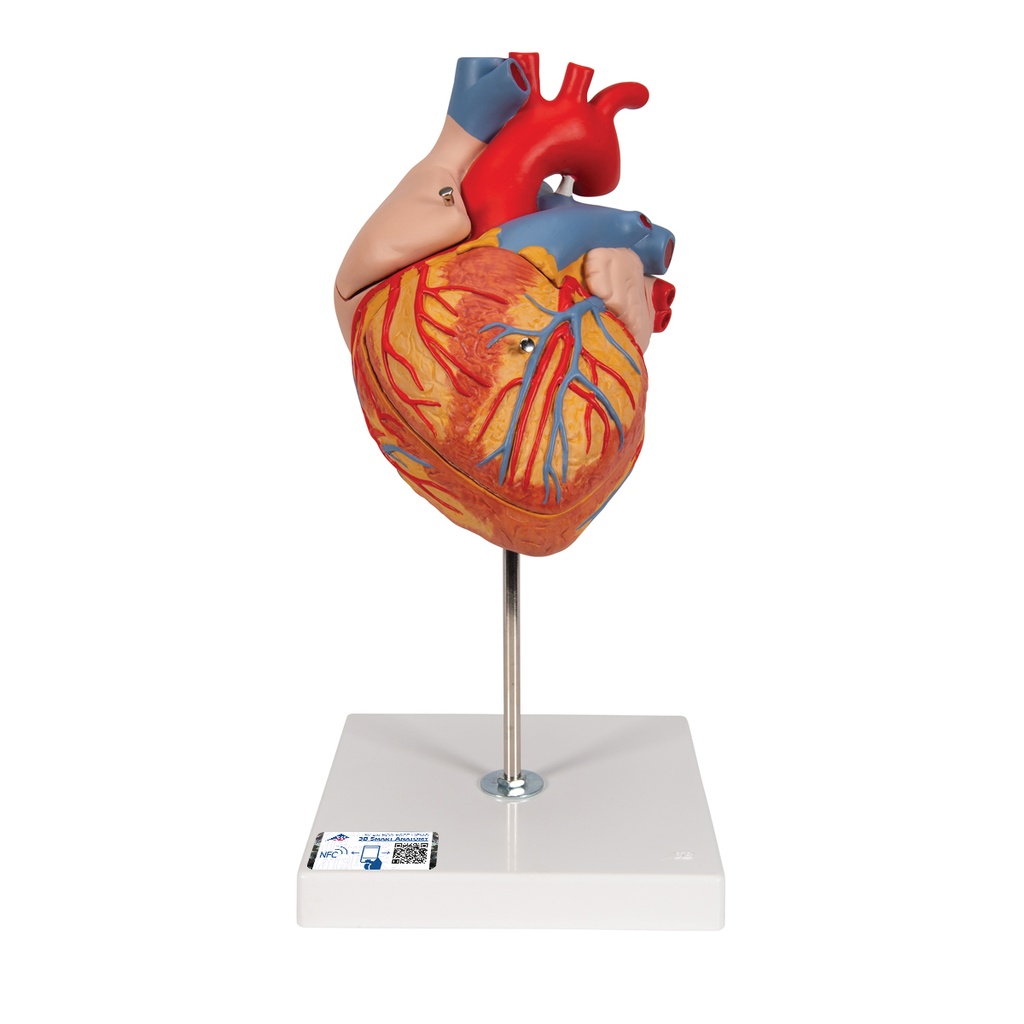Cœur taille 2 fois supérieure à la normale 3B Scientific®
