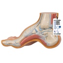 Pied creux 3B Scientific®