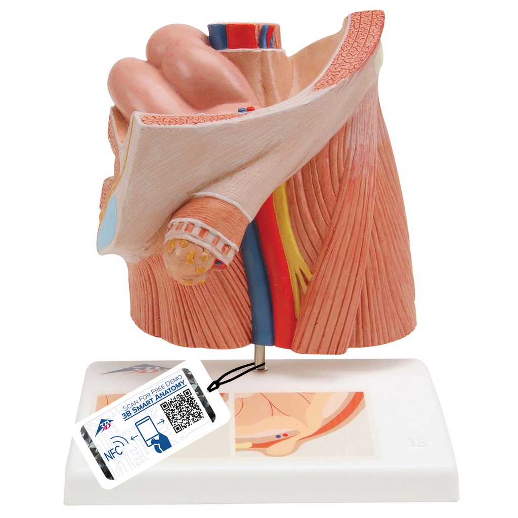 Modèle de hernie inguinale 3B Scientific®