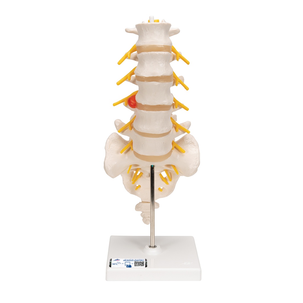 Colonne vertébrale lombaire avec section dorsale 3B Scientific®