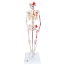 MiniSquelette avec muscles peints sur socle 3B Scientific®