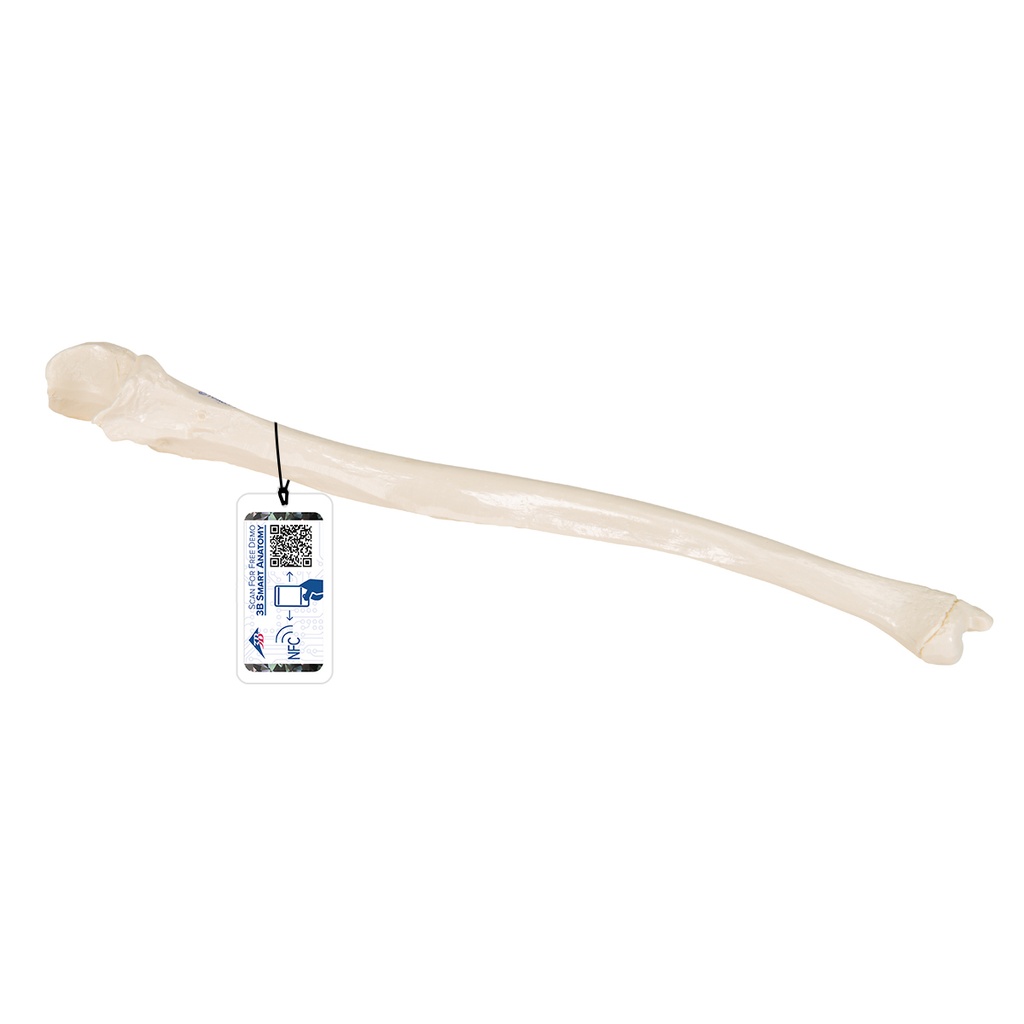Ulna 3B Scientific®