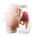 Modèle d'injection intramusculaire de fesse 3B Scientific®