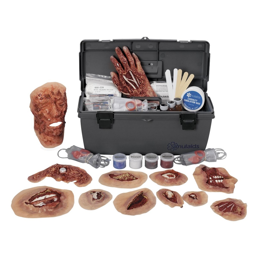 Kit de moulage Xtreme Trauma 3B Scientific®