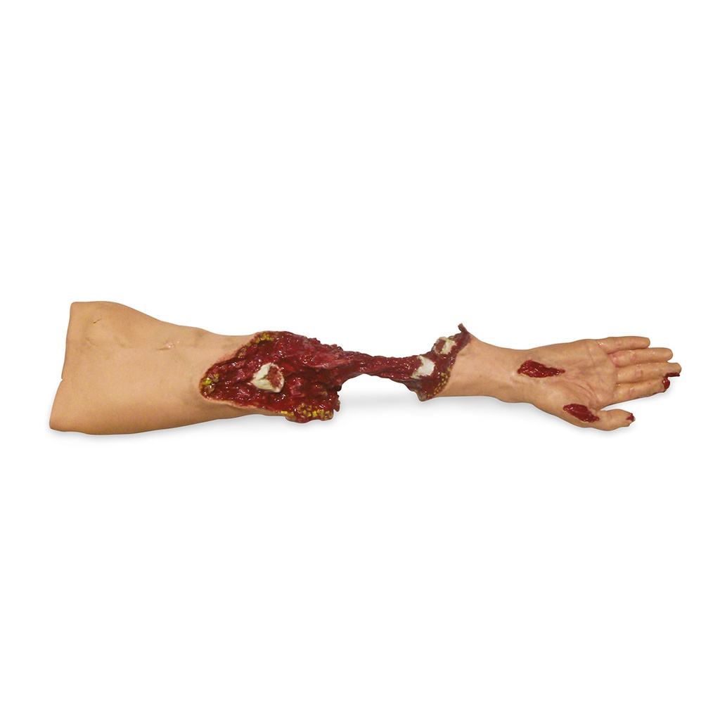 Bras de moulage trauma extrême 3B Scientific®