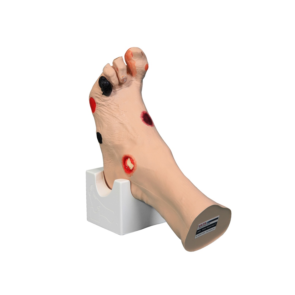 Pied Wilma Wound 3B Scientific®