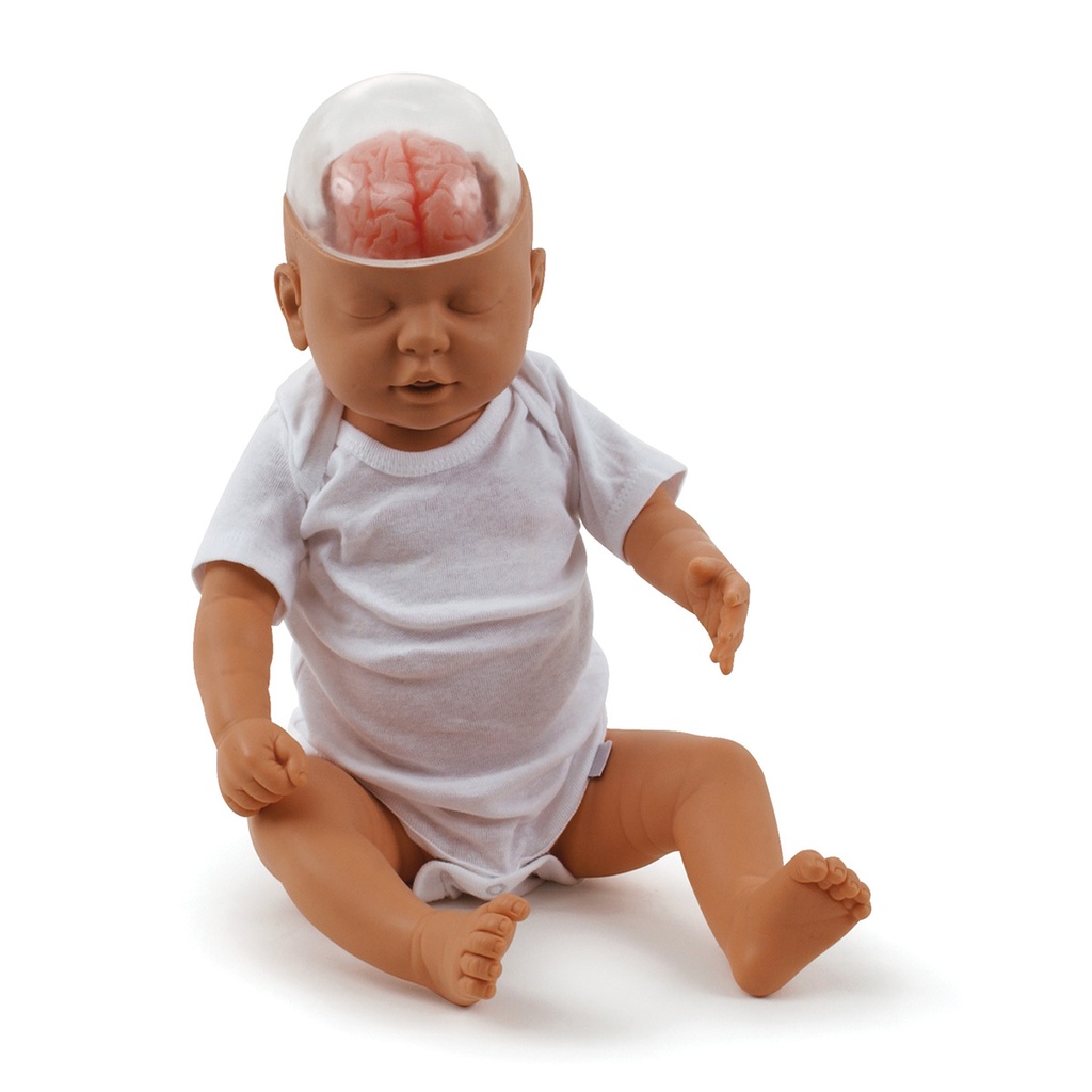 Modèle de démonstration du syndrome du bébé secoué 3B Scientific®