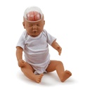 Modèle de démonstration du syndrome du bébé secoué 3B Scientific®