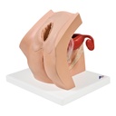 Modèle pour éducation gynécologique des patientes 3B Scientific®