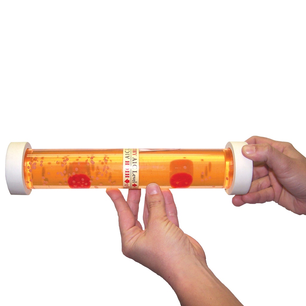 Modèle pédagogique sur les niveaux d'HbA1c 3B Scientific®