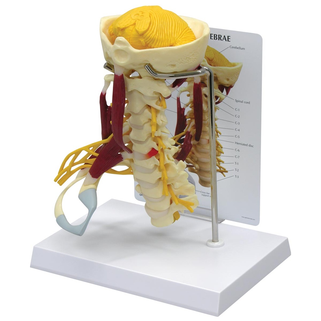 Colonne cervicale musclée de luxe 3B Scientific®