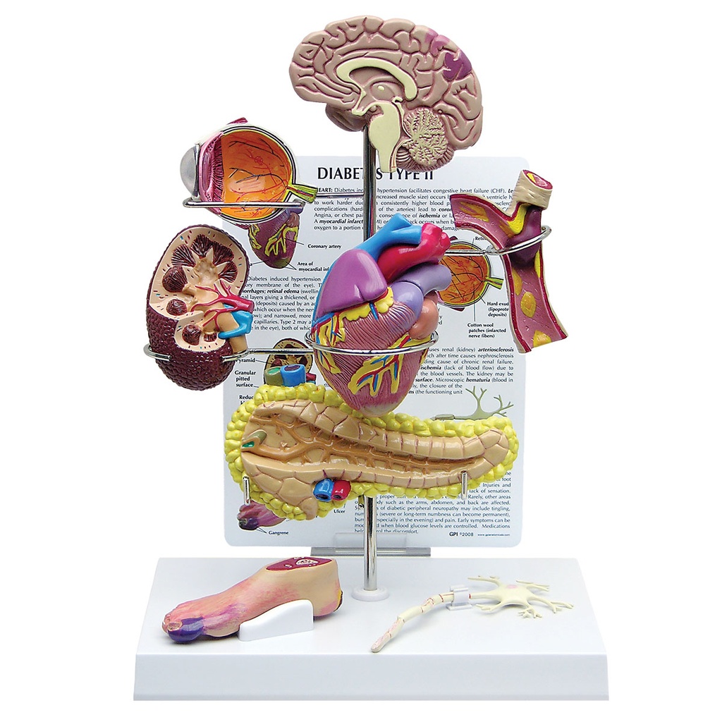 Set diabète de type II 3B Scientific®