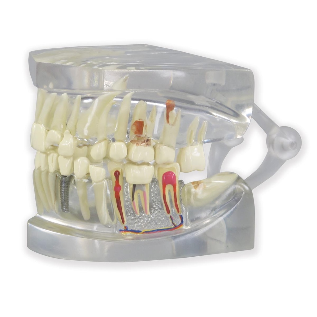 Modèle de mâchoire humaine transparente avec dents 3B Scientific®