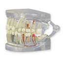 Modèle de mâchoire humaine transparente avec dents 3B Scientific®