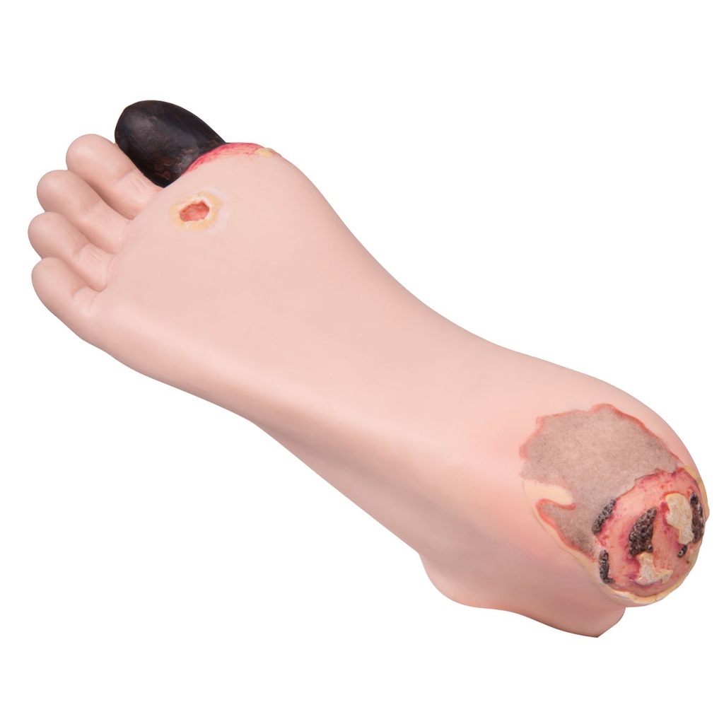 Simulateur de traitement du pied diabétique 3B Scientific®