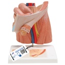 Modèle de hernie inguinale 3B Scientific®