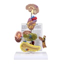 Modèle de syndrome métabolique 3B Scientific®